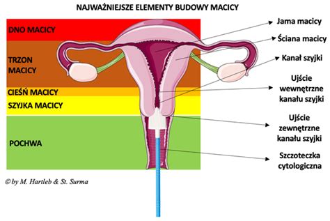 Cukrzyca A Rak Szyjki Macicy Szczeg Lna Rola Kontroli Glikemii I Profilaktyka Polskie