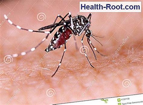 dengue fever 🏥 disease symptoms treatment 2021