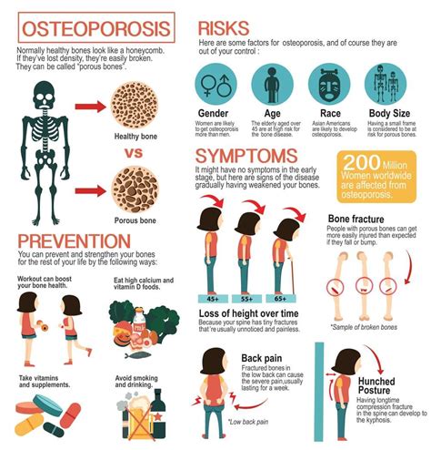 Osteoporosis Treatment In Jackson And Madison Ms