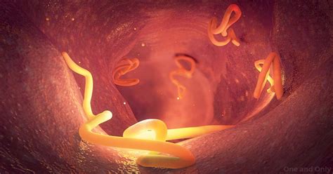 What Are The Types Of Intestinal Worms In Humans