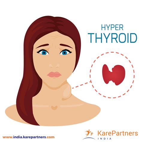 Hyperthyroidism Causes Symptoms And Treatment