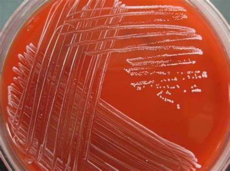 خصائص الباكتيريا على أطباق الأجار BACTERIAS CULTURAL