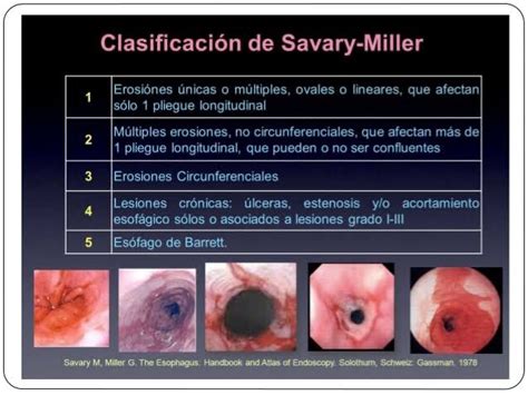 Para Recordar ENARM On Twitter Escala De Trauma Renal De La AAST