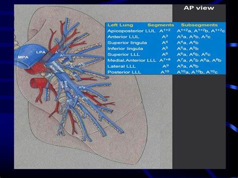 Pulmonary Artery Anatomy And Pulmonary Embolism