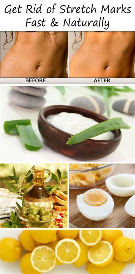 If you have stickers or sand burrs in your yard i'm sure you feel my pain. Here are TOP 10 ways to get rid of Stretch Marks fast and ...