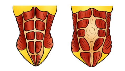 Diastasis recti is a repercussion of your pregnancy as the muscles in your abdomen separates & stretches in your body along with the pregnancy hormone called relaxin, which does the job of softening your body's connective tissue to accommodate your growing baby. Preventing Diastasis Recti in Pregnancy, avoiding ...