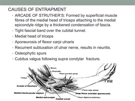 Entrapment Neuropathy Of The Upper Limb Ppt