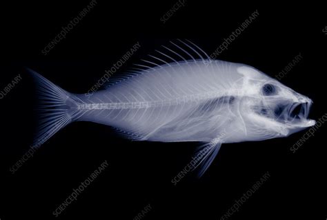 Fish X Ray Stock Image F0298523 Science Photo Library