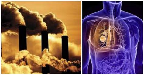 Pollution Can Take Years Off Lung Cancer Patients Lives Neopress