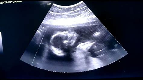 ultrasonido 4d 19 semanas de embarazo ecografia 4d youtube