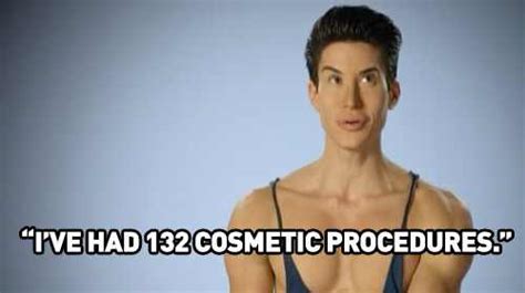 Human Ken Doll From Most Interesting Patients On Botched