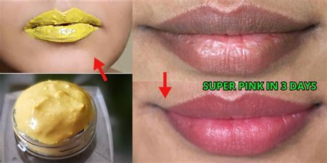 14 Sure Ways To Cure Dark Lips Naturally