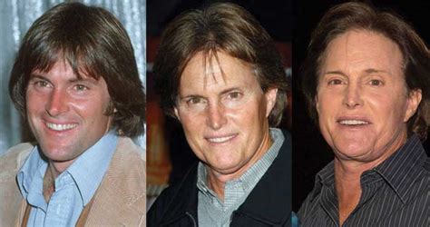 Bruce Jenner Plastic Surgery Before And After Pictures 2022