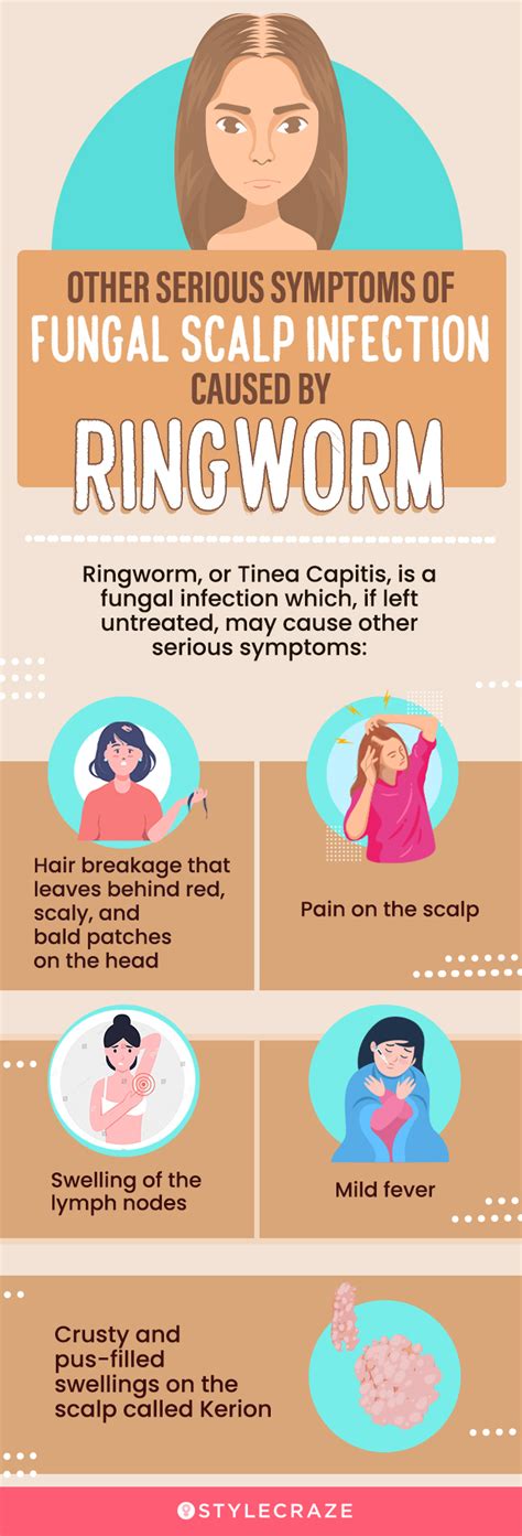 8 Home Remedies To Get Rid Of Scalp Fungus And Prevention Tips