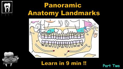 Panoramic Radiography Landmarkorthopantomogramopganatomical Landmark