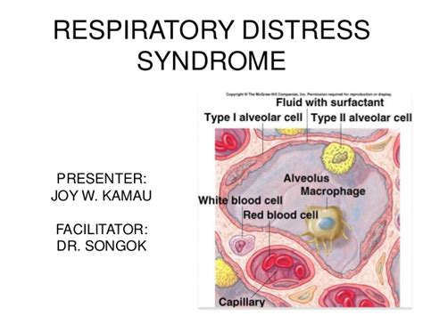 Infant Respiratory Distress Syndrome Causes And Treatment