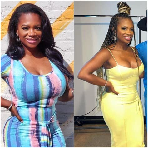 Lets Be Real With The People Kandi Burruss Details Surgical Journey Wants Other Celebrities