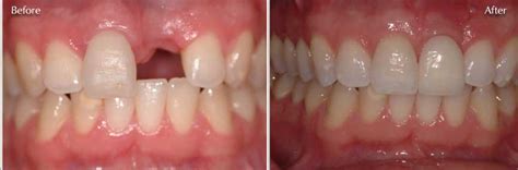 Check spelling or type a new query. Defining Restorative Dentistry - In Kevin's Words - Dallas ...