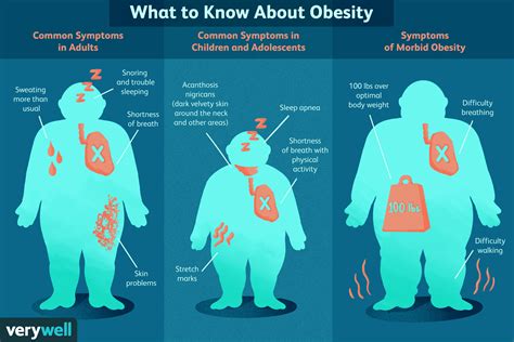 Obesity Symptoms For Adults And Children