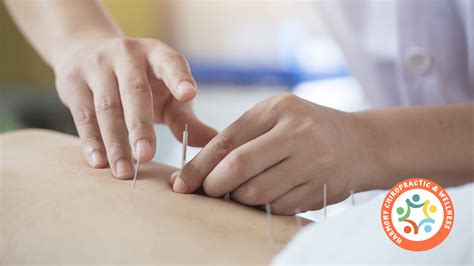 Acupuncture Kelowna Top Acupuncture And Chinese Medicine