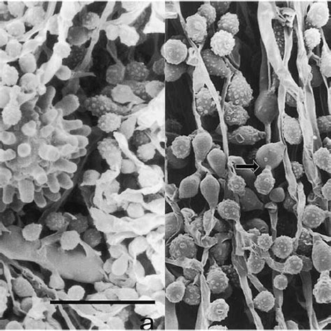Scanning Electron Microscopic Images Of H Capsulatum Var Duboisii