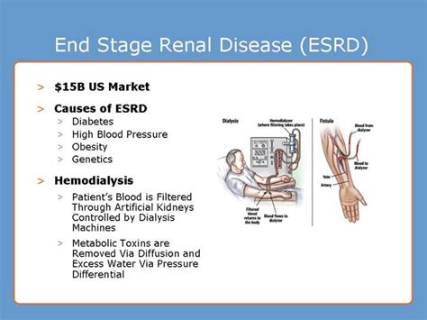 Renal failure can be divided into two categories: GRAPHIC