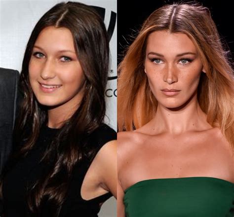 bella hadid plastic surgery before and after who magazine