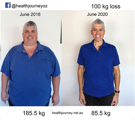 Health Journey Ive lost 100 kg in less than two years