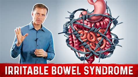 Irritable Bowel Syndrome Ibs Top 5 Tips Drberg Youtube
