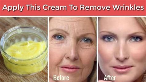 Apply This Cream And You Will Never Get Any Wrinkles On Your Skin How