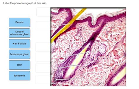 Solved Label The Photomicrograph Of Thin Skin Dermis Duc