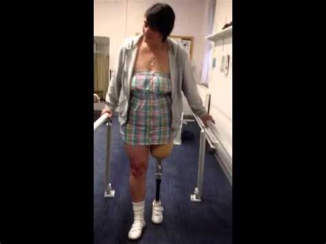 Tania S First Steps After Amputation Of Left Leg Youtube