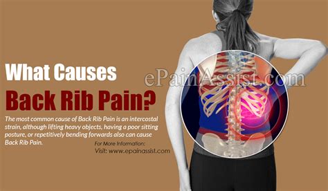 Intercostal Rib Pain