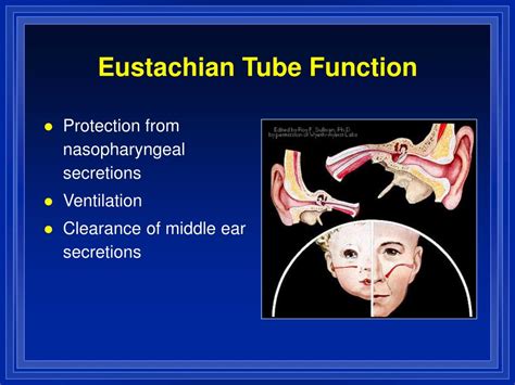 Ppt Otitis Media And Eustachian Tube Dysfunction Powerpoint
