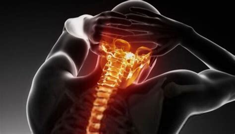 Awareness Of Spinal Arthritis And Back Pain The Physio Counsellors