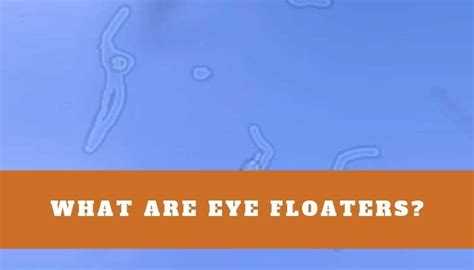 Eye Floaters What Are They And When Should You Be Concerned