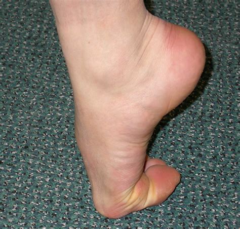 Big Toe Joint Pain Hot Sex Picture