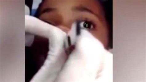 Video Shows 15 Maggots Being Removed From Schoolgirls Gums