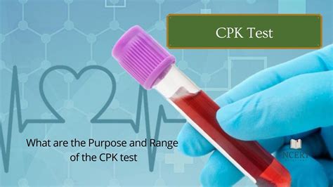 Cpk Test Process Purpose And Normal Range Ncert Infrexa