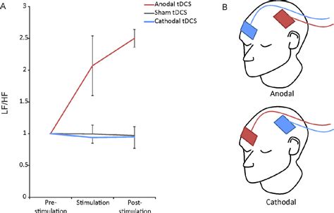Figure 1 From Anodal Transcranial Direct Current Stimulation Tdcs