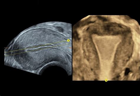How 3d Ultrasound Imaging Improvements Enhance Patient Care Empowered