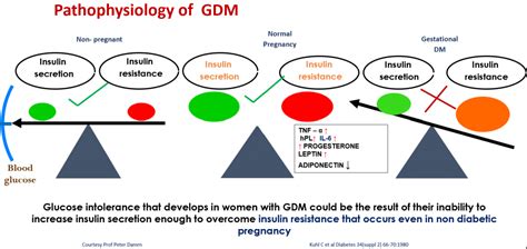 Gestational Diabetes Mellitus Gdm What A Physician Must Know Cme India