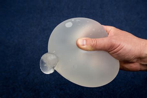 Busting Into Beauty The Silicone Filled Breast Implants Market