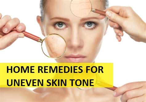 Home Remedies For Uneven Skin Tone On Face And Body