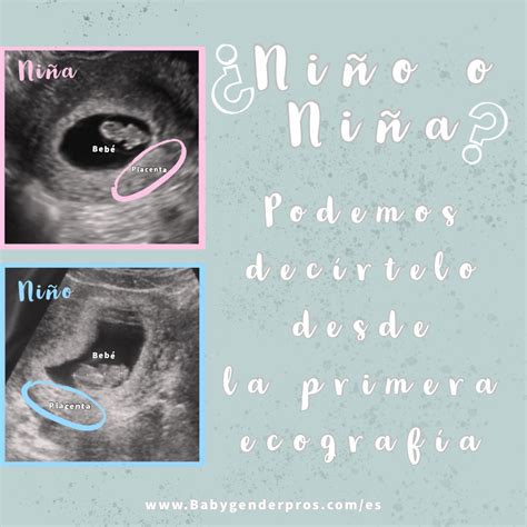 Álbumes 90 Foto Ecografia De 8 Semanas De Embarazo Mirada Tensa