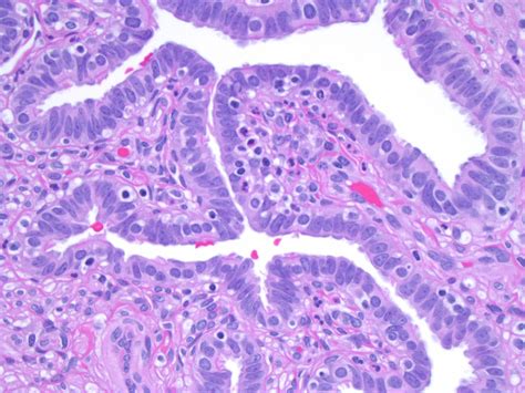 Pathology Outlines Anatomy Histology Embryology Features To Report My