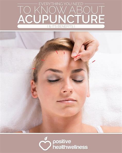 Everything You Need To Know About Acupuncture And Its Benefits