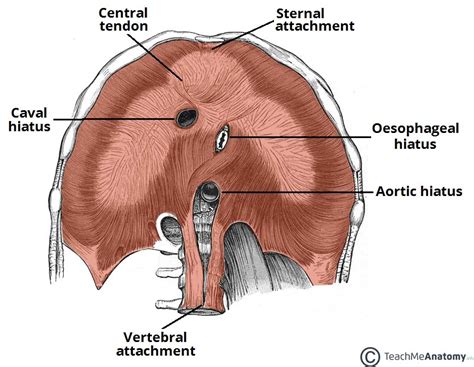 Hiatus Hernia Rolling Sliding Management Teachmesurgery