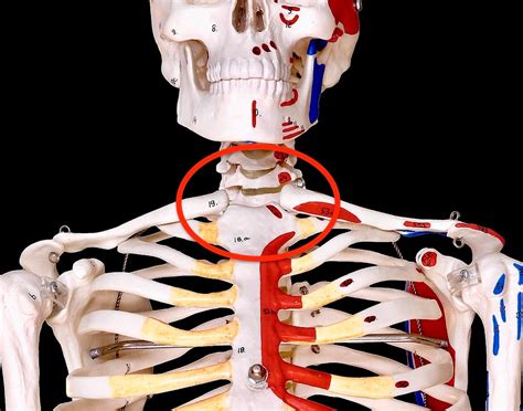 Sternoclavicular Injuries And Why They Can Be Dangerous