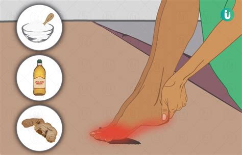 Burning Feet Causes Treatment And Home Remedies